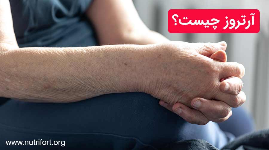 آرتروز چیست؟