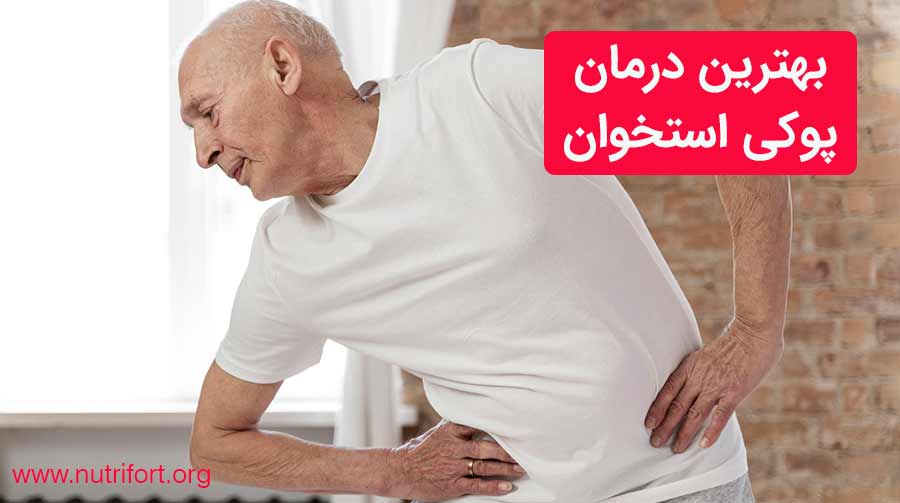 بهترین درمان پوکی استخوان