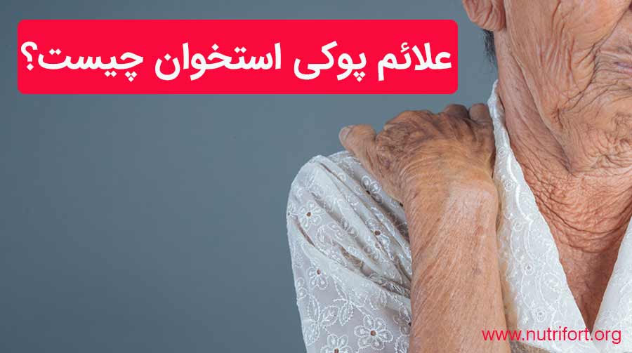 علائم پوکی استخوان چیست؟