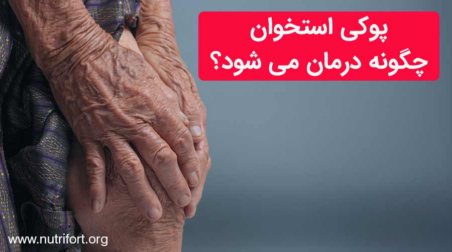 پوکی استخوان چگونه درمان می شود؟
