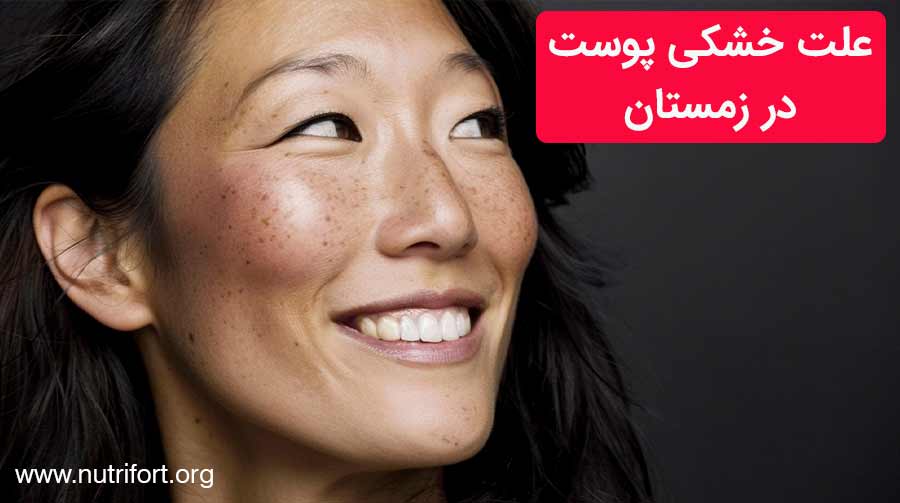 علت خشکی پوست در زمستان و راه‌های مقابله با آن
