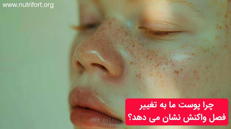 روش‌های مقابله با خشکی یا چربی پوست